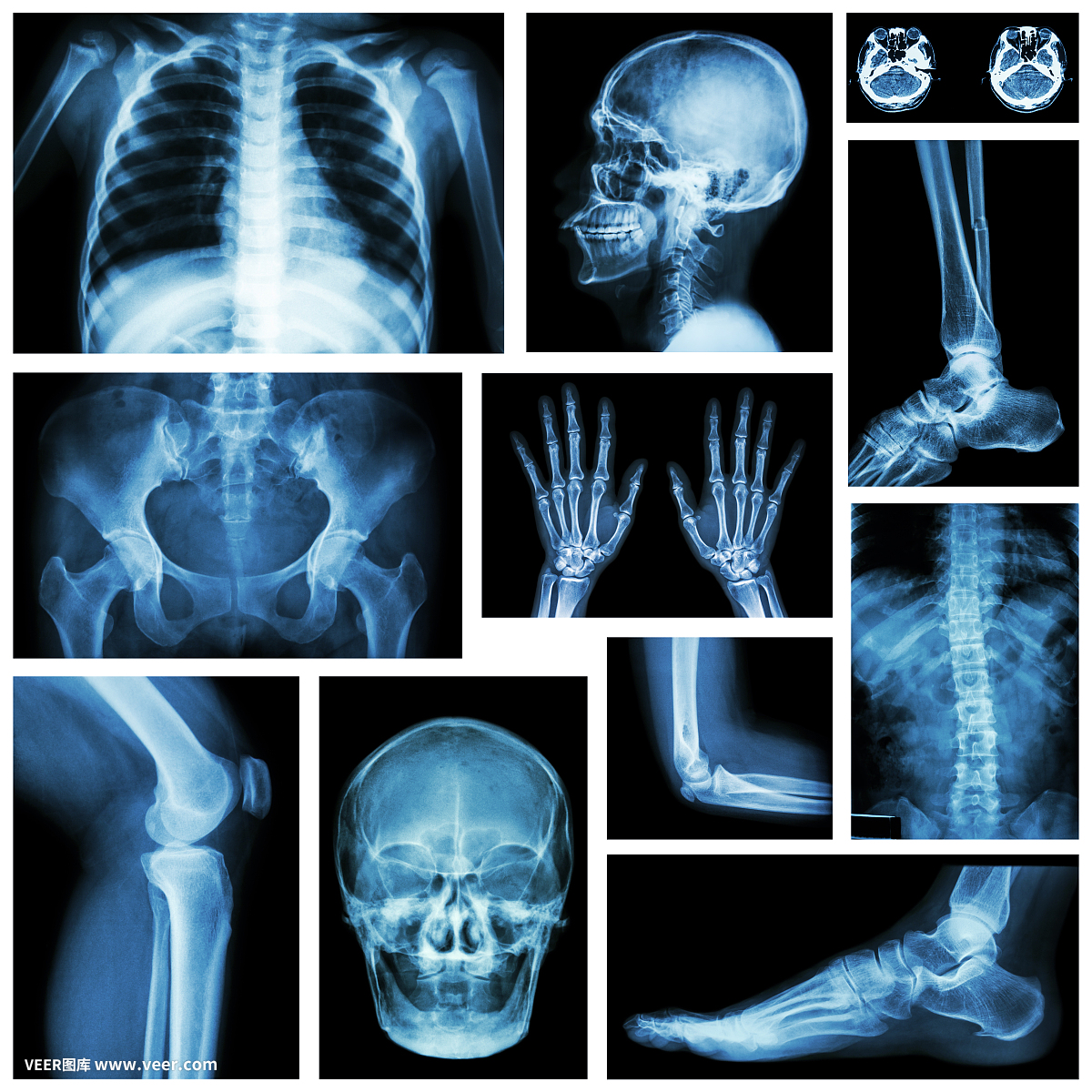 X光片,X线片,x射线照片,医院影像,X片,动物